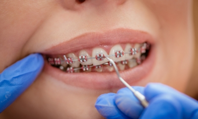 Ortodonta – kiedy warto się do niego udać?